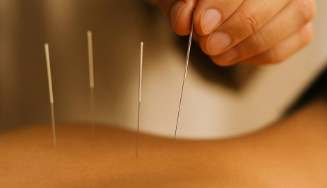 blog_conscienciaintegrativa_acupunturaparadepressao